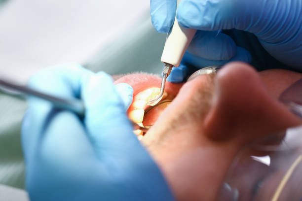 Best Chipped Tooth Repair Near Me  in Honaunau Napoopoo, HI